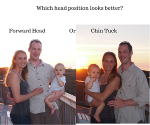Forward Head Posture vs Chin Tuck