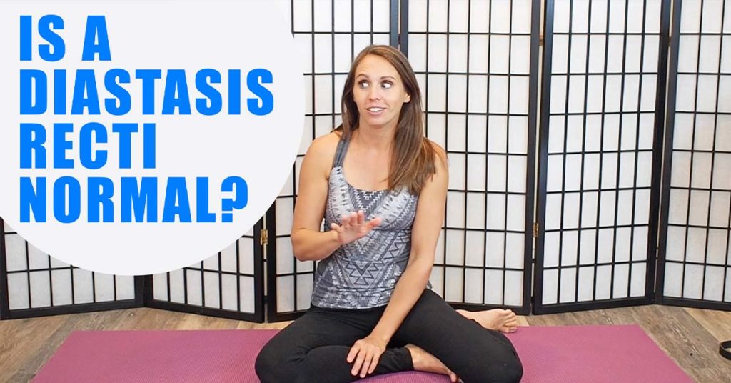 Diastasis-Normal