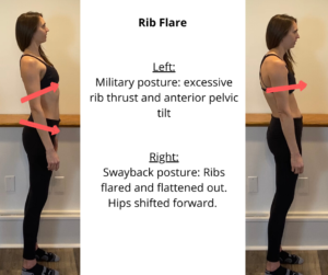What is rib flare