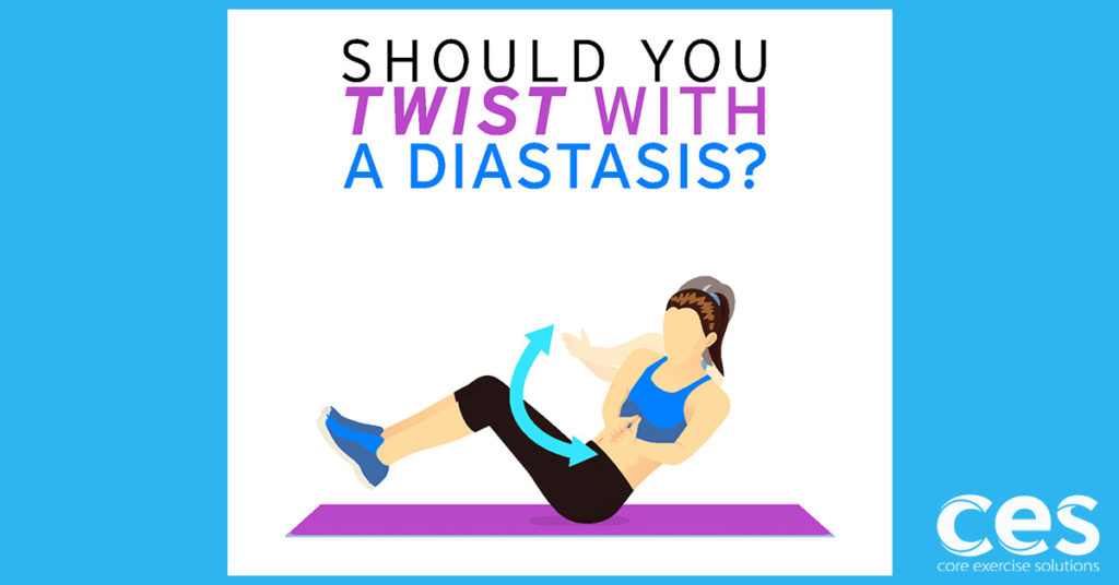 Twist-with-Diastasis