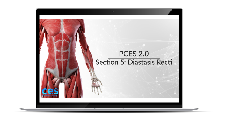 PCES Diastasis Recti Section