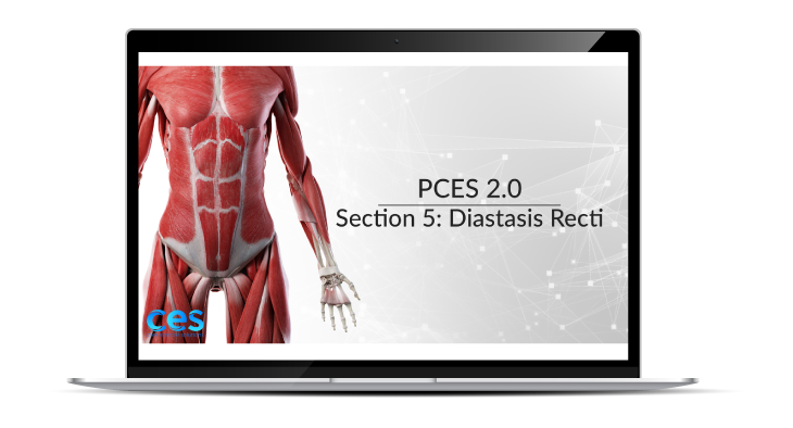 PCES Diastasis Recti Section