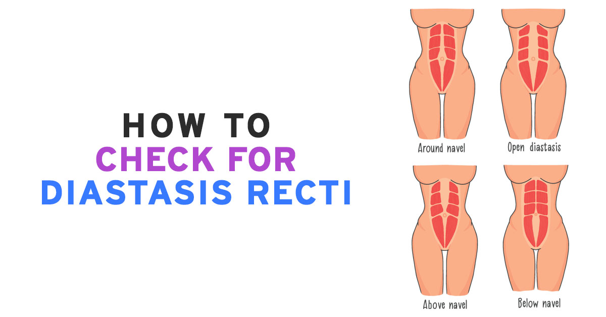 How to Check for Diastasis Recti - Core Exercise Solutions