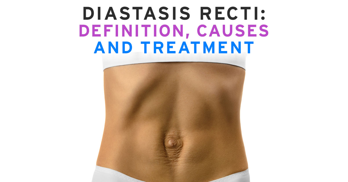 How Can You Start to Treat Diastasis Recti Yourself?