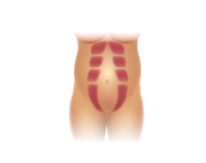 Diastasis-Recti