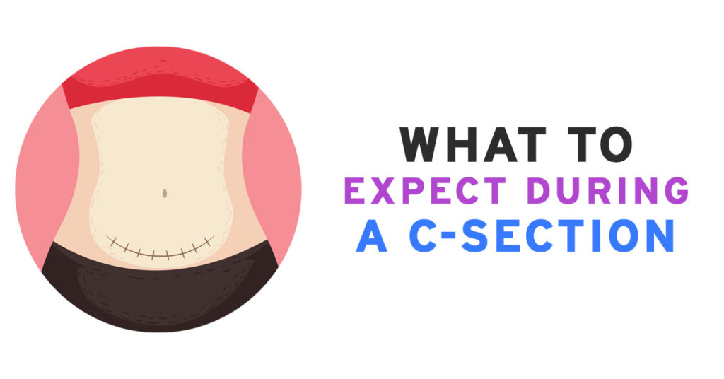 WHAT TO EXPECT DURING A C SECTION WHAT TO EXPECT DURING A C SECTION
