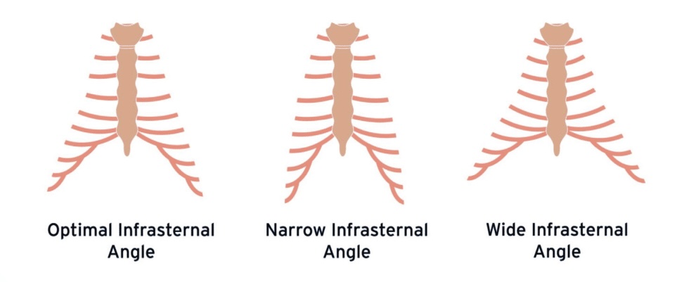ISA Angle