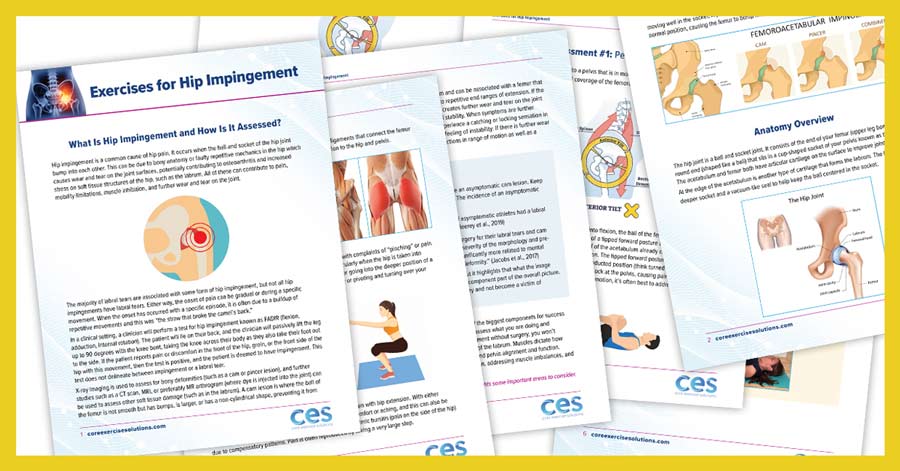 Exercises-for-hip-impingement-pdf-copy
