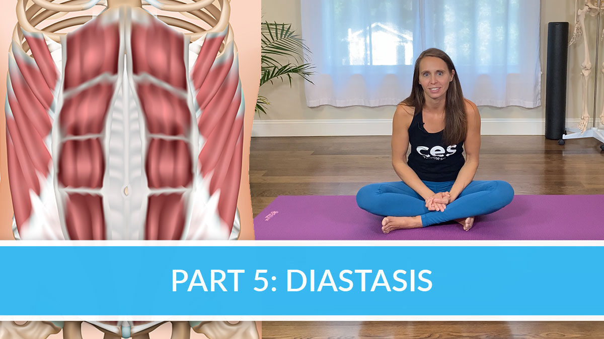 Part-5-Diastasis