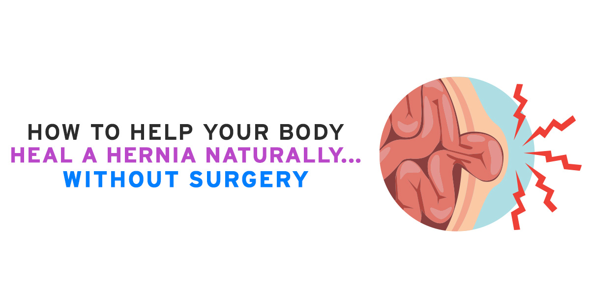 How to Help Your Body Heal a Hernia Naturally…Without Surgery - Core  Exercise Solutions
