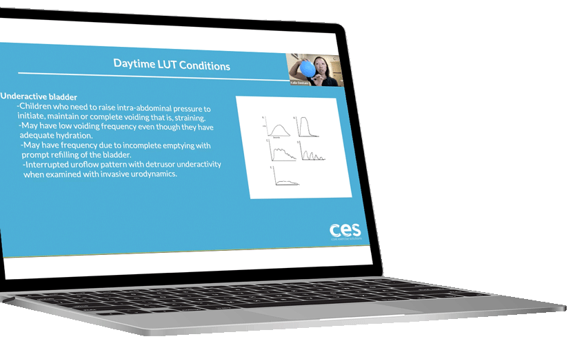 CBBD-Laptop-Left CBBD-Laptop-Left