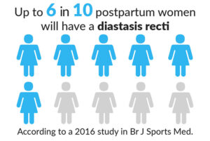 Up to 6 in 10 postpartum women will have a diastasis recti