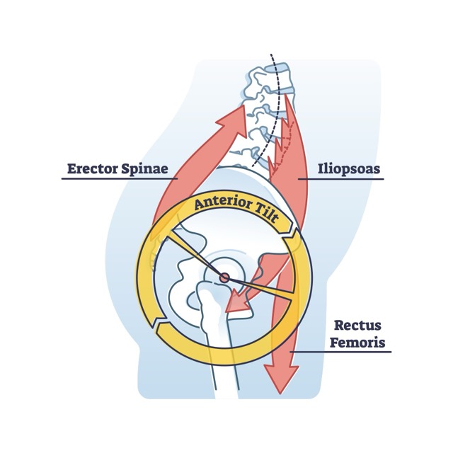 Anterior Pelvic Tilt