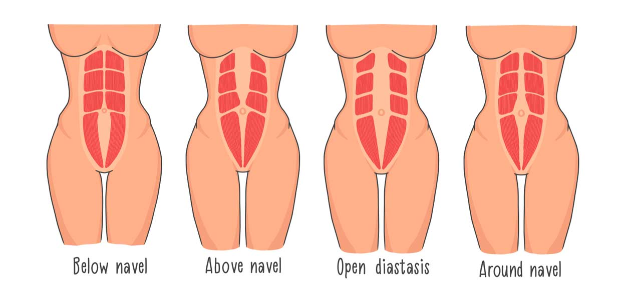 DR-in-a-line