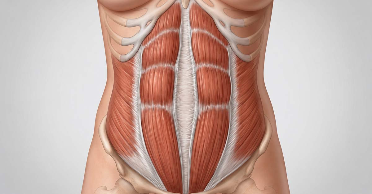 Diastasis-Recti-Illustration
