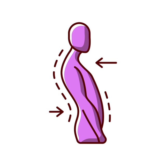 Swayback Posture